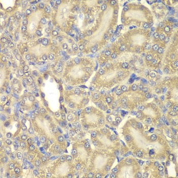 Immunohistochemistry of paraffin-embedded Rat kidney using Myelin Basic protein Polyclonal Antibody at dilution of  1:200 (40x lens).