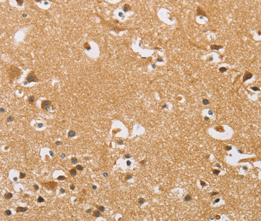 Immunohistochemistry of paraffin-embedded Human brain  tissue using ARHGEF1 Polyclonal Antibody at dilution 1:50