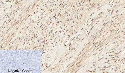 Immunohistochemistry of paraffin-embedded Human uterus tissue with Phospho-ERK 1/2 (Tyr204) Polyclonal Antibody at dilution of 1:200