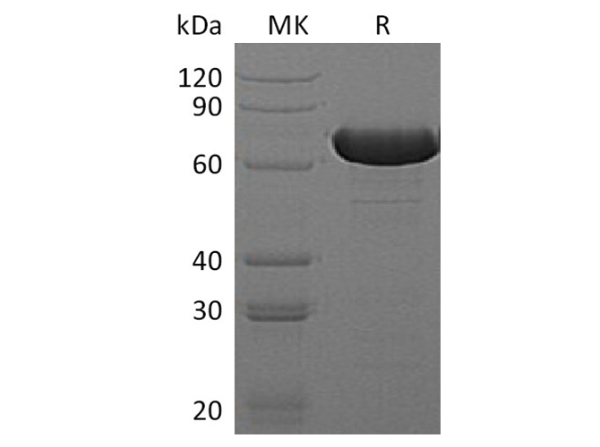 Recombinant E.coli Beta-Glucuronidase/Uida/Beta-Gus Protein (His Tag)