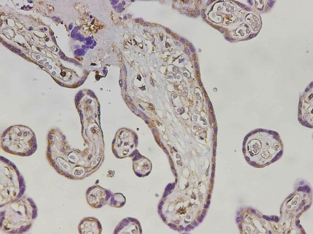 Immunohistochemistry of paraffin-embedded Human placenta tissue using MHCG Polyclonal Antibody at dilution of 1:3000(?400)