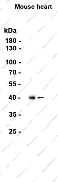 Recombinant Cardiac Troponin T Monoclonal Antibody - 1