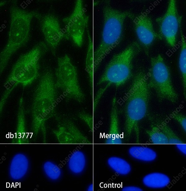 Recombinant NGF/NGFB Monoclonal Antibody - 2
