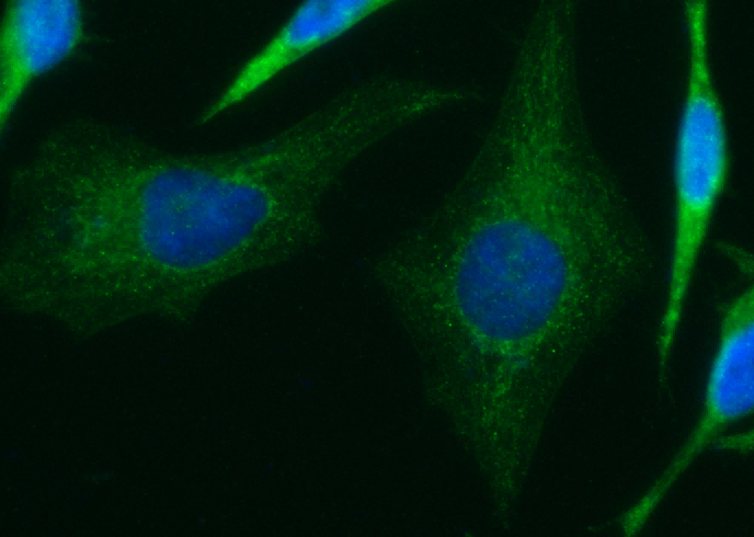 Isovaleryl-CoA dehydrogenase/IVD Monoclonal Antibody - small - 2