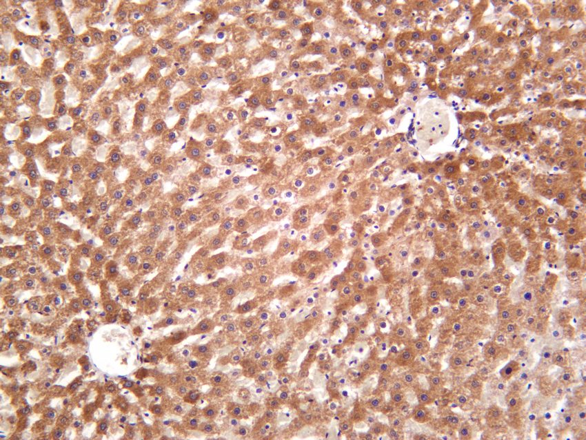 Recombinant IFNGR1/CD119/IFN-gamma-R1 Monoclonal Antibody - 3