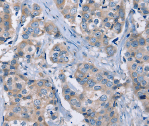 KCNQ5 Polyclonal Antibody - 3