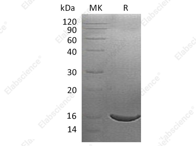 Recombinant Human ISG15/G1P2 Protein (His Tag) - 1