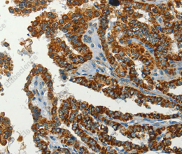 SERPINA9 Polyclonal Antibody - 2