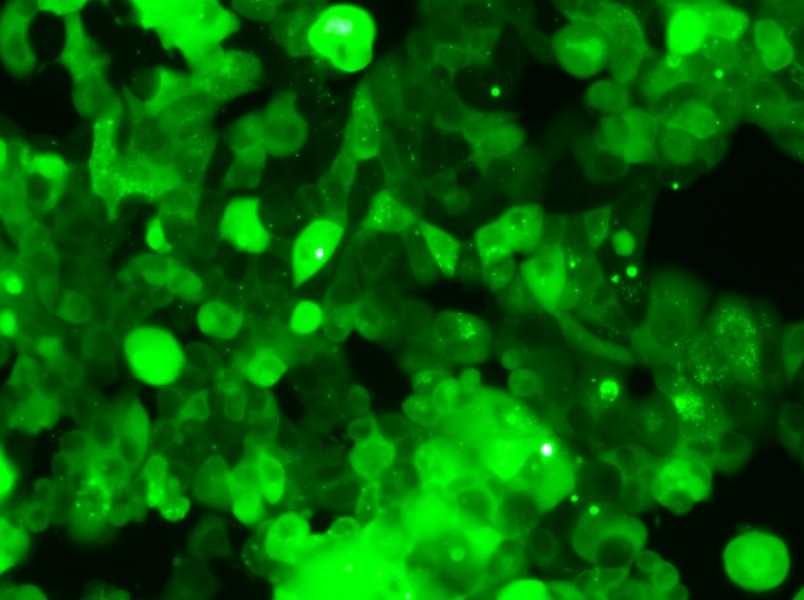 MCF-7-GFP Cell Complete Medium - 4