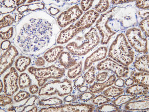Recombinant TOMM70 Monoclonal Antibody - 2