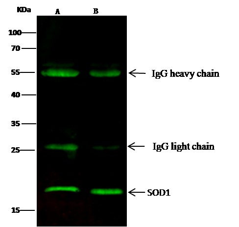 SOD1/Superoxide Dismutase Monoclonal Antibody - small - 2