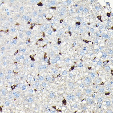 Immunohistochemistry of paraffin-embedded mouse liver using CORO1A Polyclonal antibody at dilution of 1:100 (40x lens).Perform high pressure antigen retrieval with 10 mM citrate buffer pH 6.0 before commencing with IHC staining protocol.