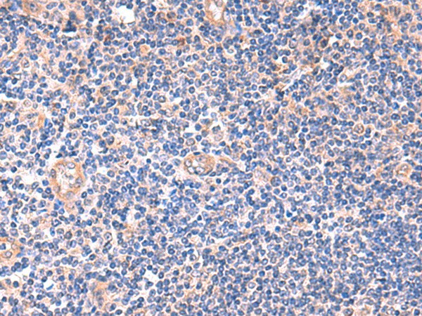 Immunohistochemistry of paraffin-embedded Human tonsil tissue  using ZNF256 Polyclonal Antibody at dilution of 1:120(?200)