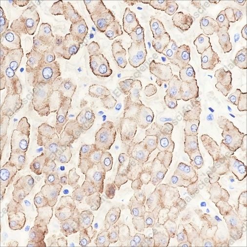 Recombinant ASGR1 Monoclonal Antibody - 4