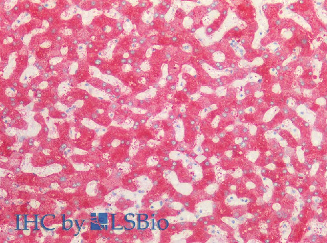 Immunohistochemistry of paraffin-embedded Human liver using PCK1 Polyclonal Antibody at dilution of 1:100(Elabscience Product Detected by Lifespan).