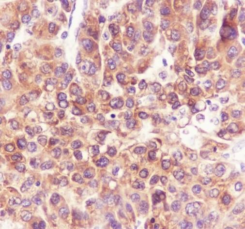 Recombinant PGRMC2 Monoclonal Antibody - small - 2