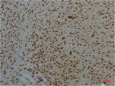 Immunohistochemistry of paraffin-embedded Mouse brain tissue using STAT3 Monoclonal Antibody at dilution of 1:200.