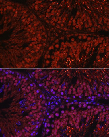 Immunofluorescence analysis of rat testis using C1orf146 Polyclonal Antibody at dilution of 1:100 (40x lens). Blue: DAPI for nuclear staining.