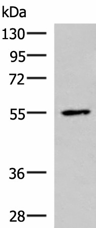 Western blot analysis of HepG2 cell lysate  using ISM1 Polyclonal Antibody at dilution of 1:1000