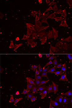 Immunofluorescence analysis of MCF7 cells using MSRA Polyclonal Antibody