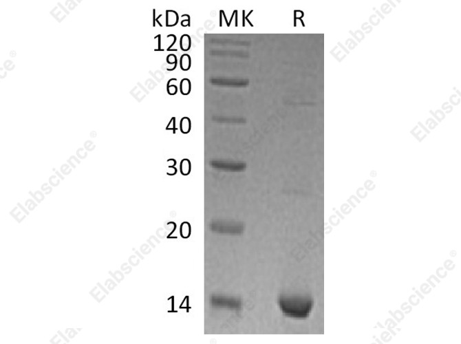 Recombinant Human S100A9 Protein - 1