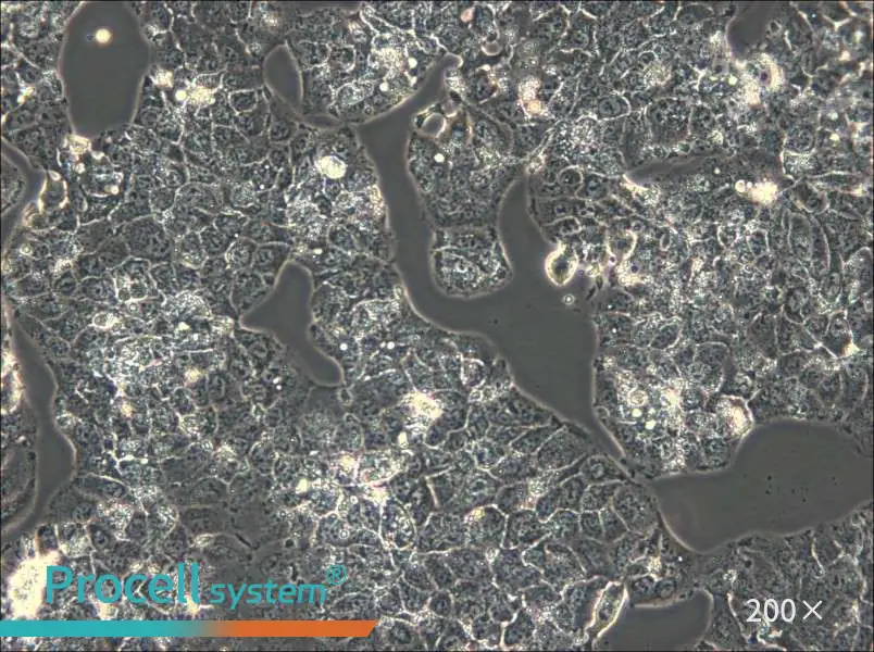 HuH-1 Cell Complete Medium - 6