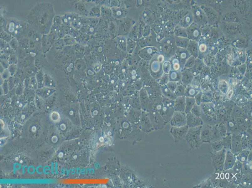 HARA-B Cell Complete Medium - small - 6