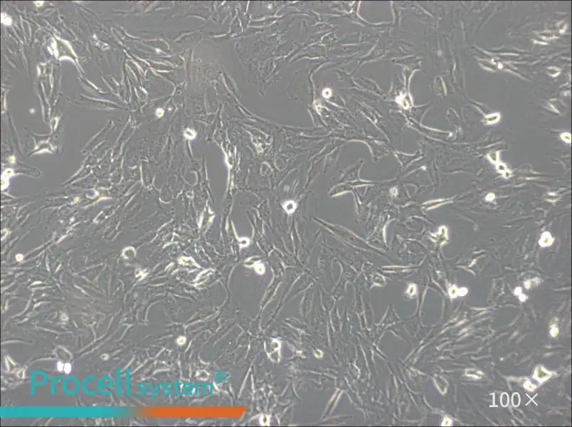 SW1783 (DMEM) Cell Complete MediumSW1783 (DMEM) Cell Complete Medium - 2