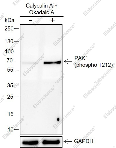Recombinant Phospho-PAK1 (Thr212) Monoclonal Antibody - 3