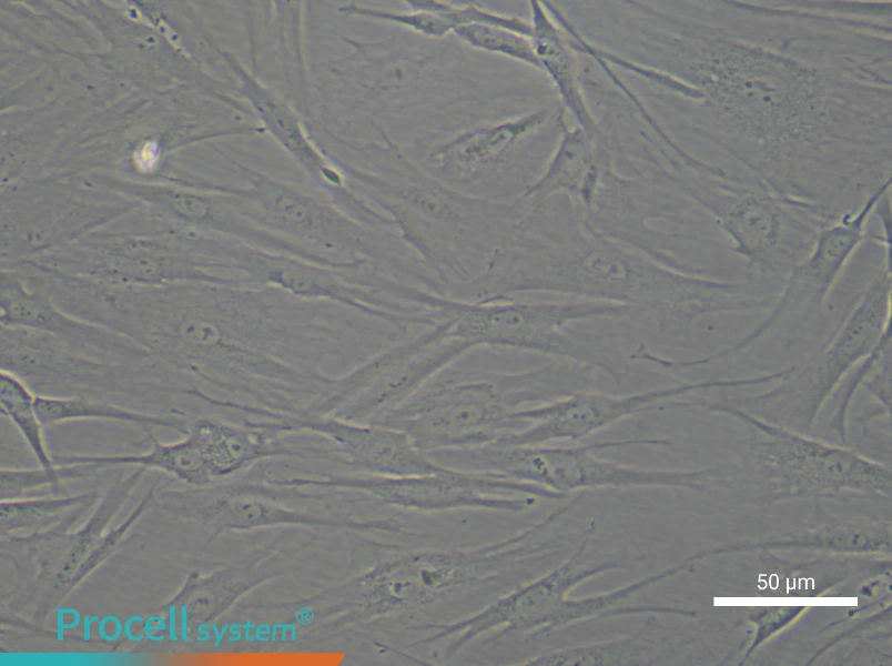 Human Aortic Adventitial Fibroblast Complete Medium - 5
