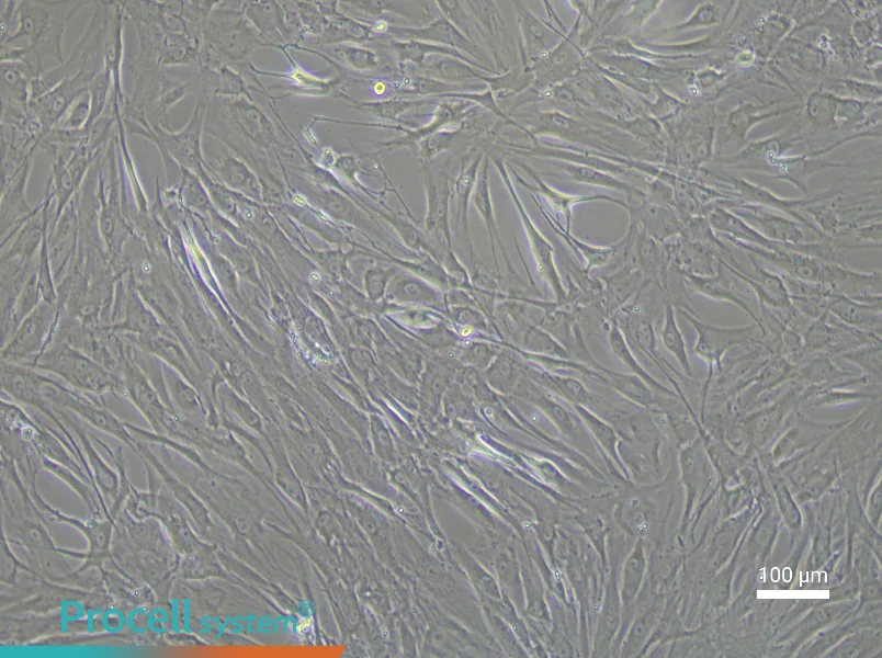 Human Corneal Stromal Cell Complete Medium - 2