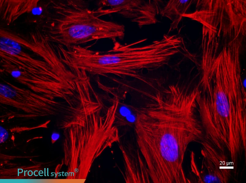 Mouse Uterine Smooth Muscle Cell Complete Medium - 2