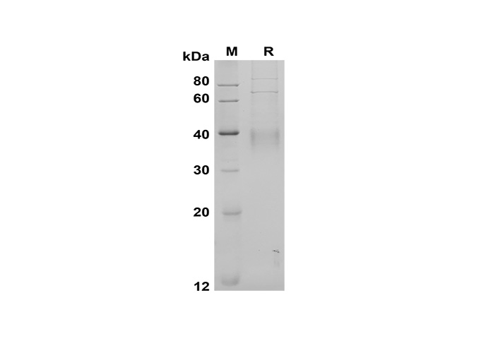 Recombinant Human CCL27 Protein(Trx Tag)-产品推荐-1