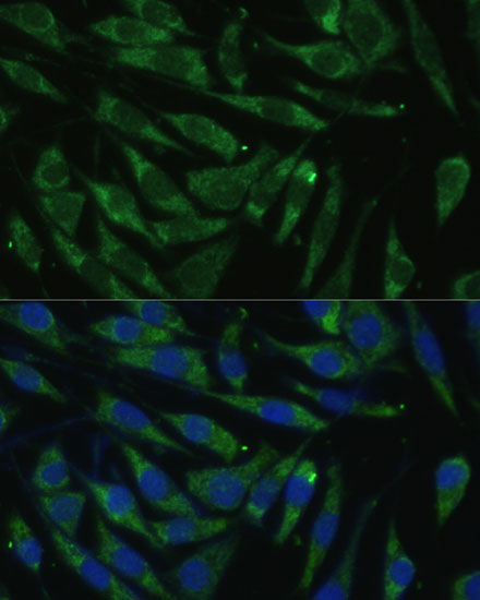 Immunofluorescence analysis of L929 cells using PITRM1 Polyclonal Antibody at dilution of 1:100 (40x lens). Blue: DAPI for nuclear staining.