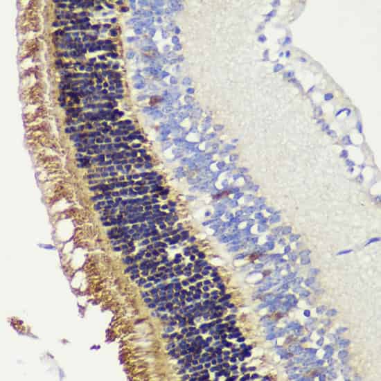 Immunohistochemistry of paraffin-embedded Mouse retina using RCVRN Polyclonal Antibody at dilution of 1:200 (40x lens).