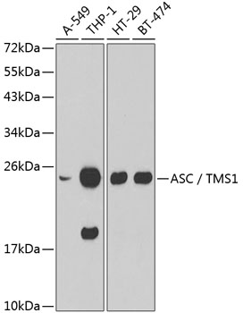 Western blot analysis of extracts of various cell lines using ASC / TMS1 Polyclonal Antibody.