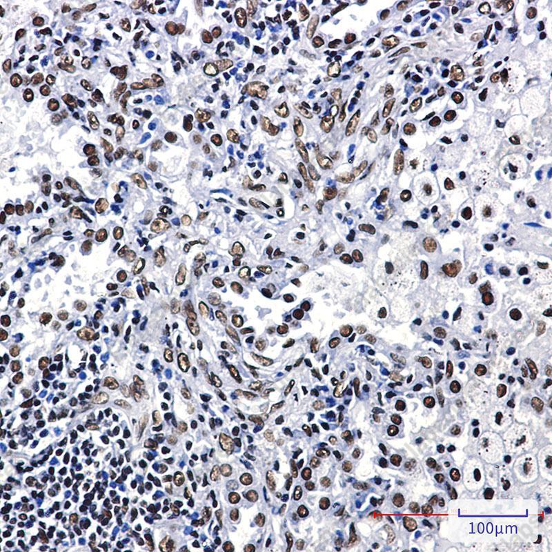Recombinant ILF3 Monoclonal Antibody - 3