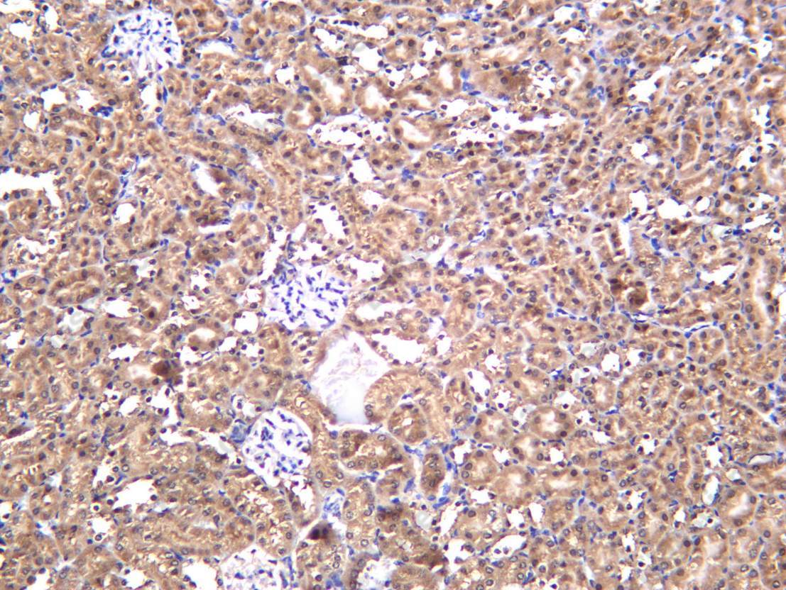 Recombinant Skp1 Monoclonal Antibody - 1