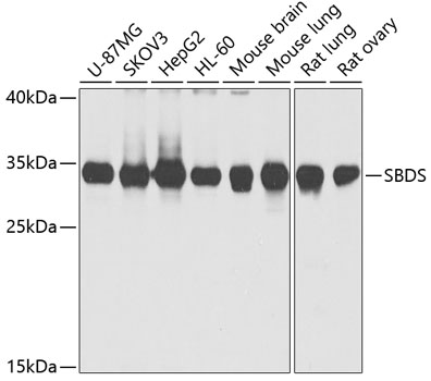 Western blot analysis of extracts of various cell lines using SBDS Polyclonal Antibody at 1:1000 dilution.