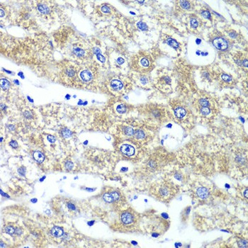 Immunohistochemistry of paraffin-embedded Human liver damage using QARS Polyclonal Antibody at dilution of 1:100 (40x lens).