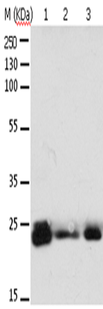 Western Blot analysis of 293T cell and Mouse brain tissue, A549, Hela, A172 and HT-29 cell using RAB6A Polyclonal Antibody at dilution of 1:650