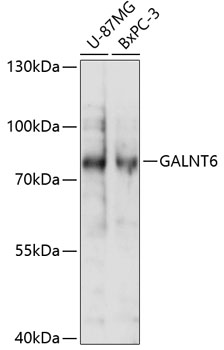 Western blot analysis of extracts of various cell lines using GALNT6 Polyclonal Antibody at 1:1000 dilution.