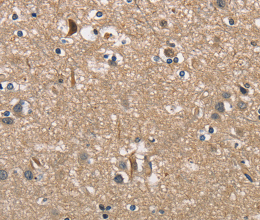 PGK1 Polyclonal Antibody - 3