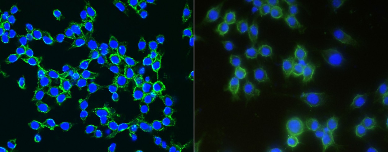 Recombinant LDLR/LDL Receptor Monoclonal Antibody-searchlist-1