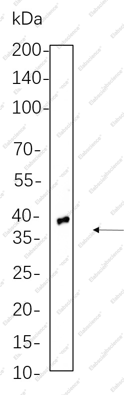 Recombinant TTF1 Monoclonal Antibody - 1