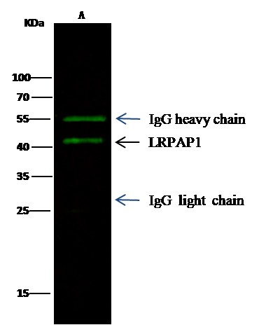 LRPAP1/A2MRAP Monoclonal Antibody - small - 2
