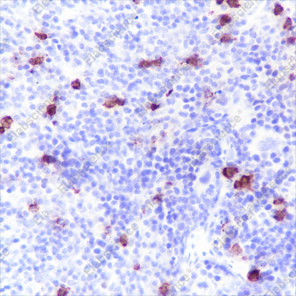 Recombinant S100A8 Monoclonal Antibody - 3