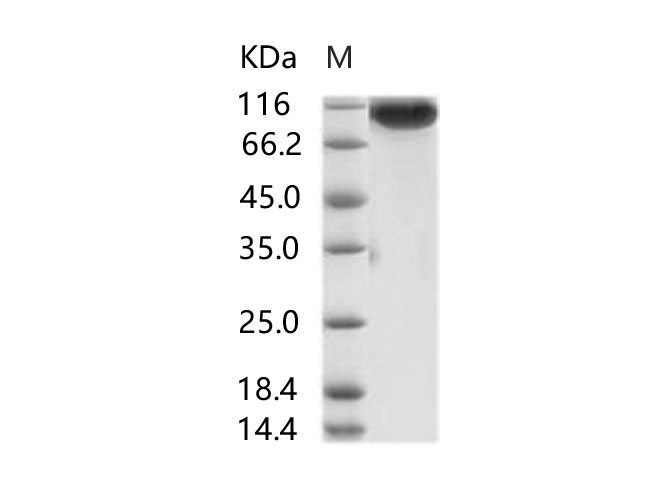 1. Immobilized Spike Protein S1 (aa 1-725) (Cat: PKSV030241) at 10 ug/ml (100 ul/well) can bind biotinylated human DPP4 (Cat: PKSH033811). The EC50 of of biotinylated DPP4 (Cat: PKSH033811) is 0.6-1. 39 ug/ml. 2. Immobilized Spike Protein S1 (aa 1-725) (Cat: PKSV030241) at 10 ug/ml (100 ul/well) can bind biotinylated Fc-DPP4 (Cat: PKSH030456). The EC50 of biotinylated Fc-DPP4 (Cat: PKSH030456) is 0.02-0.05 ug/ml.