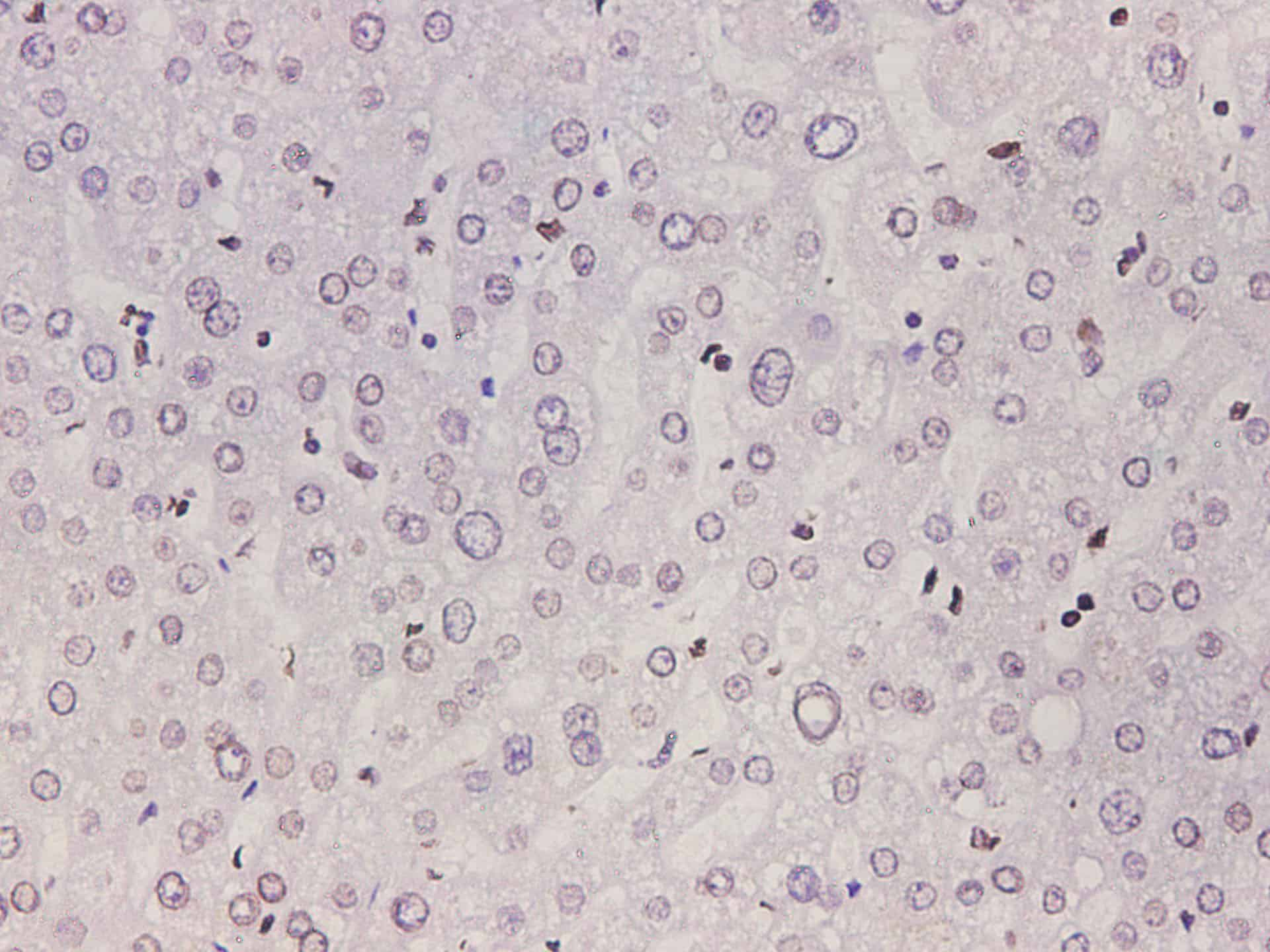 Immunohistochemistry of paraffin-embedded Human liver tissue using Lamin-B1 Polyclonal Antibody at dilution of 1:600(?400)