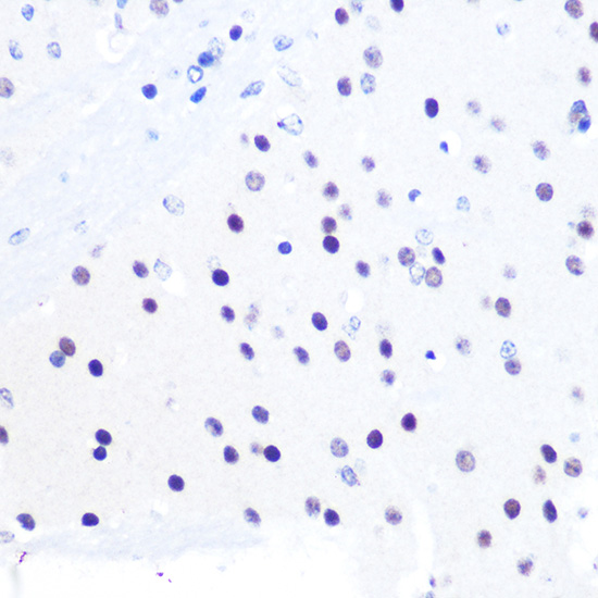 Immunohistochemistry of paraffin-embedded mouse brain using PEG3 Polyclonal Antibody at dilution of 1:100 (40x lens).Perform microwave antigen retrieval with 10 mM PBS buffer pH 7.2 before commencing with IHC staining protocol.